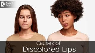 Know Why you get DARK , PIGMENTED LIPS | What causes DARK LIPS? -Dr. Renuka Shetty| Doctors' Circle