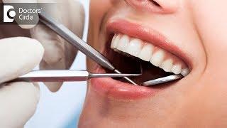 Indications of wisdom teeth extractions - Dr. Sangeeta Honnur
