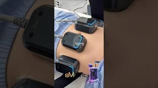 뱃살 다이어트 최신 트렌드 #뱃살운동 #다이어트브이로그