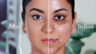 STEP-BY-STEP FULL COVERAGE FLAWLESS FOUNDATION ROUTINE ON UNEVEN SKIN