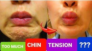 IMMEDIATELY Relax your CHIN | Chin Tension | Chin Massage