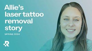 Allie's Laser Tattoo Removal Journey