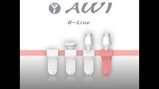 AWI Keramikimplantate G-Line Implantat mit internem Sinuslift