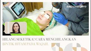 Cara Mudah Menghilangkan Bintik Hitam Pada Wajah