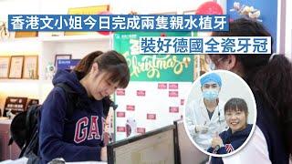 【維港口腔種牙】香港文小姐完成兩隻親水植牙，裝好德國全瓷牙套！#全瓷牙套治療 #親水種植牙 #植牙牙醫推薦 #珠海維港口腔  #維港口腔 #深圳植牙 #深圳種植牙 #深圳戴牙套