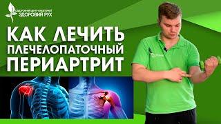 ТОП 9 Упражнений. Боль в плече - как лечить плечелопаточный периартрит | КИНЕЗИТЕРАПИЯ