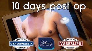 GYNECOASTIA POST-OP RESULTS (10 DAYS) - Dr. Lebowitz