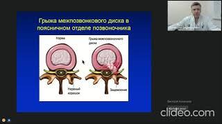Лечение межпозвоночной (межпозвонковой) грыжи. Рассказывает нейрохирург Дуров Олег Владимирович