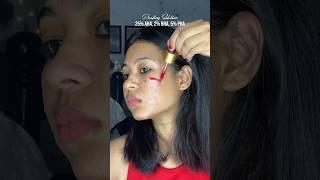 Applying blood on my skin  pilgrim aha bha pha peeling solution honest review 