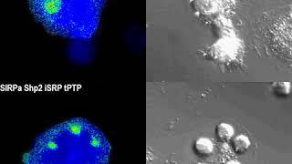 Smart proteins make macrophages better cancer-eating machines