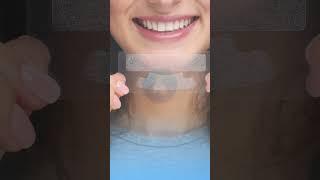 Brighten Your Smile: Top Teeth Whitening Solutions from Smiles Royale 