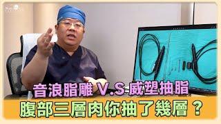 腹部抽脂心得分享! 腹部抽脂 音浪脂雕 vs 威塑抽脂 技巧大揭密! ｜林敬鈞醫師｜巨星整形外科