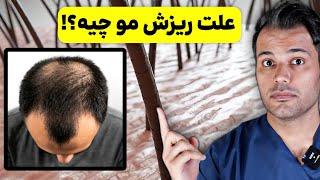 5 علت ریزش مو چیه و چجوری درمان میشه؟