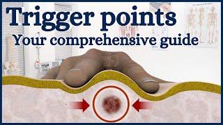 Guide to trigger points