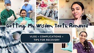 Getting Your Wisdom Teeth Removed? Watch This First! | VLOG + Complications + Tips For Recovery