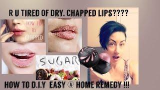 HOW TO GET RID OF Dry Lips FAST