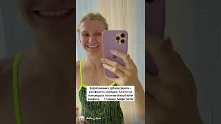 #shorts Відбілювання зубів в Дарлін  Кейс пацієнтки Наталі