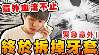 瑋瑋拆掉牙套了！卻意外血流不止，緊急去醫院‧‧‧ 【黃氏兄弟】隱形牙套 牙齒矯正 隱適美