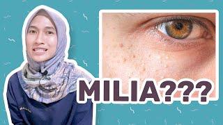 Cara Menghilangkan Milia pada Wajah | dr. Vania Utami