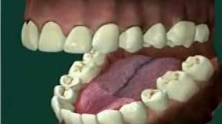 PARADONT.flv