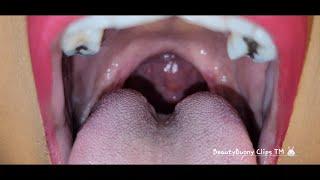 ASMR OPEN WIDE UVULA EXAMINATION