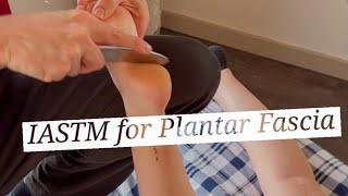 Plantar Fascia (IASTM) Instrument Assisted Soft Tissue Mobilization