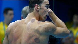 What is cupping? In 60 seconds