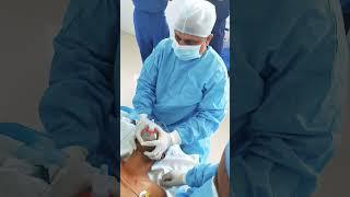 Anesthesia for Cleft Surgery