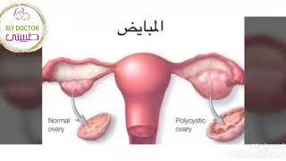 تكيس المبيض |علاج لا يلتفت إليه الأطباء| أشهر ٣ أعراض و خطة علاجهم《الجزء الأول》د/ ريهام الشال