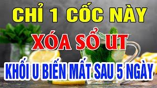 Bác Sỹ Mách Bạn Uống Trà Xanh Với Chanh Cực Tốt Cho Sức Khỏe, Ai Cũng Nên Uống Để Khỏe Mạnh Mỗi Ngày