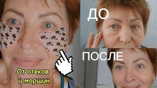 Убрала Отеки за 15 минут!Не ожидала такого результата!Показываю До и После