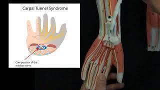 Upper Limb Nerves on a plastic 3D replica