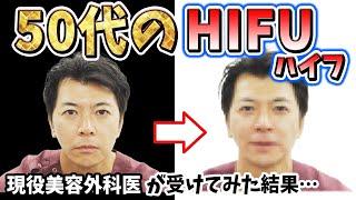 【たるみ治療】50代男性が医療HIFU（ハイフ）を受けたら変化が凄すぎた