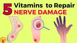 5 Vitamins For Nerve Damage Repair | Vitamins for Neuropathy | VisitJoy