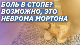 НЕВРОМА МОРТОНА. ДИАГНОСТИКА И ЛЕЧЕНИЕ. ДОКТОР ТРАВМАТОЛОГ-ОРТОПЕД ИГОРЬ ПАХОМОВ.