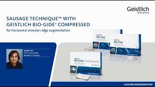Sausage TechniqueTM with Geistlich Bio-Gide Compressed® for horizontal alveolar ridge augmentation