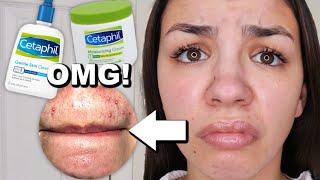 I Used Cetaphil Skincare For One Week!