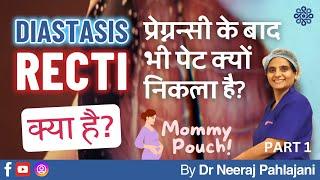 प्रेग्नन्सी के बाद भी पेट निकला हुआ? What is Diastasis Recti? (Part 1) - Dr Neeraj Pahlajani