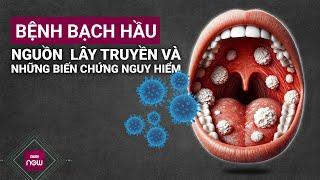 Bệnh bạch hầu đang là tâm điểm chú ý: Nguồn lây truyền và những biến chứng nguy hiểm như thế nào?