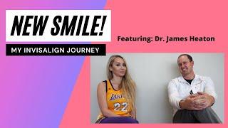 New Smile! | My Invisalign Journey | Claudia Fijal