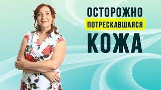 Осторожно! Потрескавшаяся кожа.