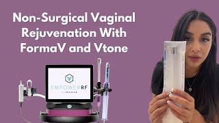 Non-Surgical Vaginal Rejuvenation with FormaV and Vtone