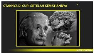 Otak Einstein Di Curi Dan Di Iris Iris Setelah Kematiannya