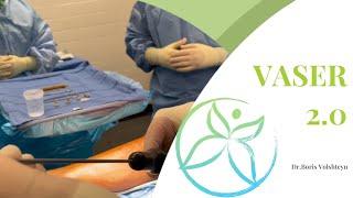 Lipedema - Liposuction With Vaser 2.0 - Dr. Boris Volshteyn