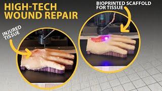 3D bioprinting to help heal wounds | Headline Science