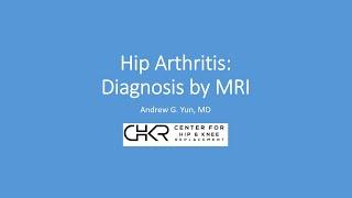 X-Ray vs MRI in the Diagnosis of Hip Arthritis