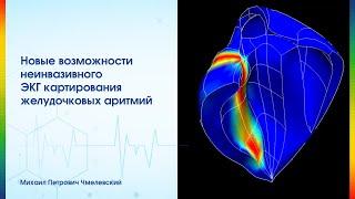 Новые возможности неинвазикного ЭКГ картирования желудочковых аритмий