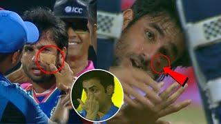 Ravi Bishnoi Injured just below Eye against Srilanka during India vs Srilanka 1st T20I Match