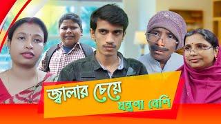 Jalar Cheye Jontrona Besi || জ্বালার চেয়ে যন্ত্রনা বেশি || SRS ENTERTAINMENT PRESENT||