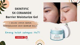 Skintific 5x Ceramide Moisture Gel Review || Solusi untuk semua permasalahan skin barrier kulit